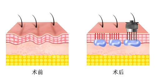 水光原理