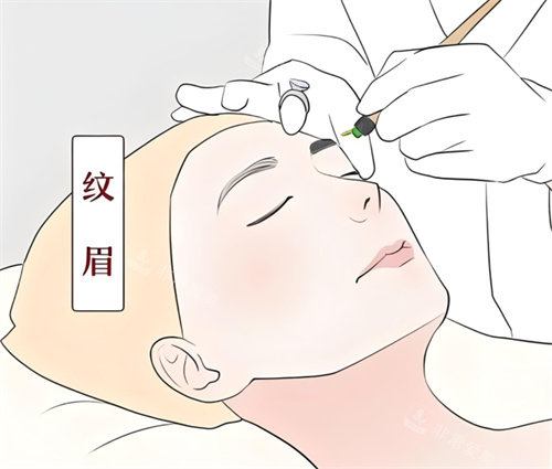 紋眉進行圖