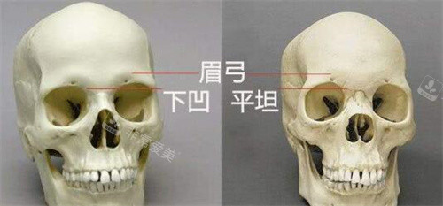 眉弓骨對比展示骨骼圖 眉弓骨對比展示骨骼圖