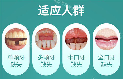 种植牙适应人群