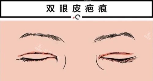 韩国眼部修复十大医生推荐，曹仁昌/朴相炫/高汉雄上榜都是有名的双眼皮修复医生！