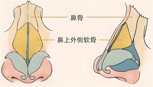 宽鼻矫正完后悔了吗？我的经历告诉你千万要慎重选择！