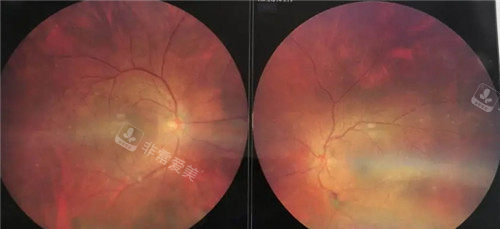 在韩国看眼科贵不贵？韩国眼科医院收费体系价格适中 过程透明！