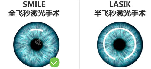 在韩国看眼科贵不贵？韩国眼科医院收费体系价格适中 过程透明！