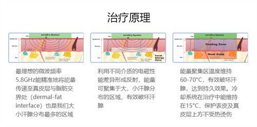 清新微波去腋臭技术原理图解