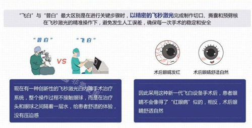 愛(ài)爾眼科的飛白和普白手術(shù)