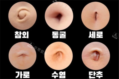 韩国肚脐整形医院排名:KS整形/Link林克整形/丽迪安整形做肚脐整形手术有名口碑好!