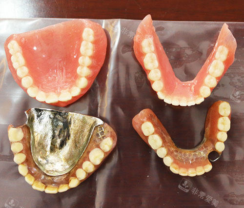 不同材料的义齿实物展示图