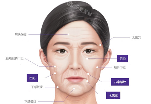 韩国lifton皮肤科怎么样?是韩国有名皮肤科,打玻尿酸/激光仪器抗衰口碑好!