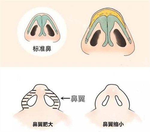 韩国整容全脸要多少万?我在韩国做全脸部整容花了30万