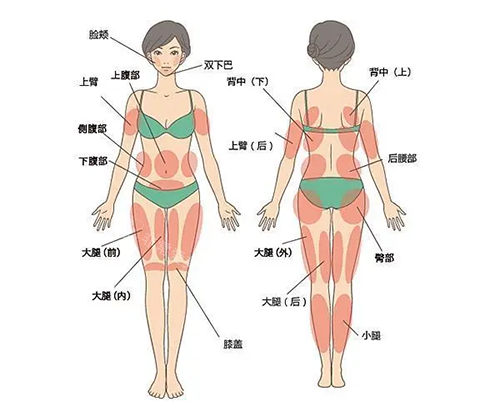 吸脂身体部位图片