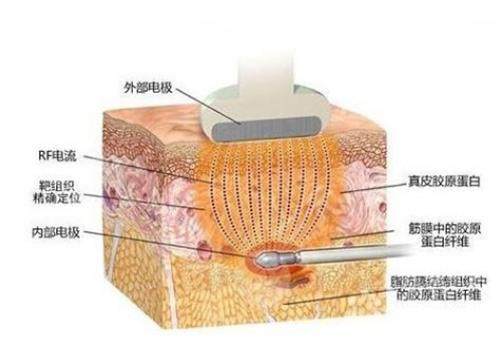 黄金微雕的作用