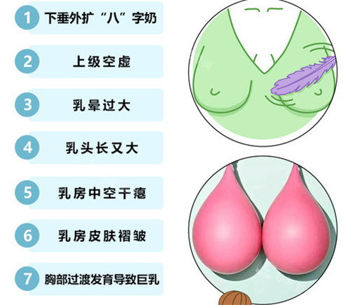 胸部矫正适应症