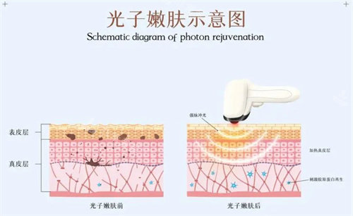 韩国blancjou皮肤科靠谱吗？在诸多皮肤科中他家设备多仪器全 治疗能力也比较强！