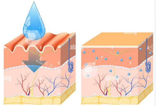 玻尿酸注射前后皮肤变化
