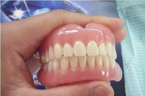 吸附性假牙图