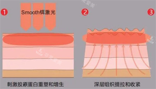 揭秘:韓國藝德雅整形醫(yī)院怎么樣?看看鞠光植代表院長的抗衰老手術技術吧~