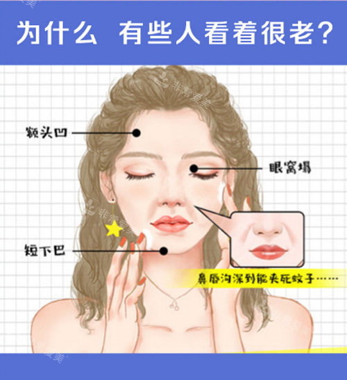 韩国脂肪填充医院推荐哪家?Melon整形外科/Bion整形/Seojin整形都可放心冲!