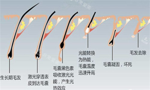 菏泽脱毛哪家医院好？美思慕丨丽都丨御美汇丨种花家丨禾丽都可做激光脱毛~