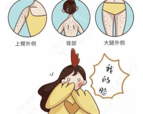 身體各部位雞皮膚的展現(xiàn)