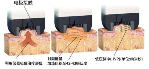 鉆石超塑的原理