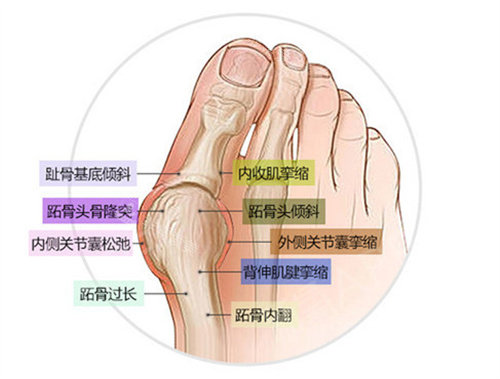 大腳骨的表現 大腳骨的表現