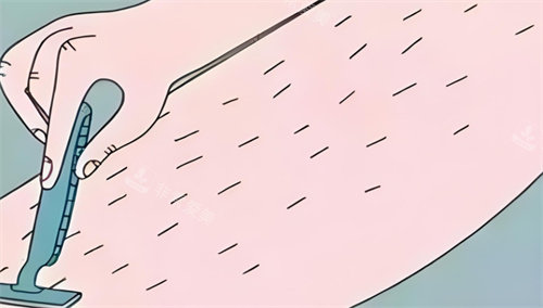 脫毛手動刮