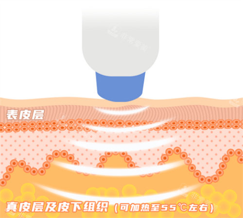 热玛吉原理