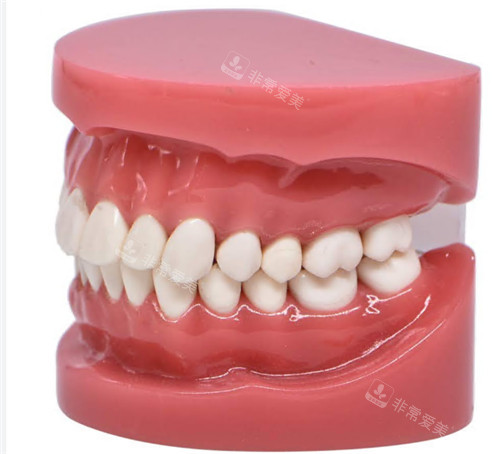 牙齿模型图展示