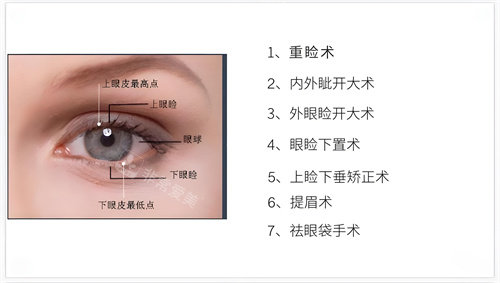 用我做眼综合整形的经历告诉你韩国做眼整形哪家好？