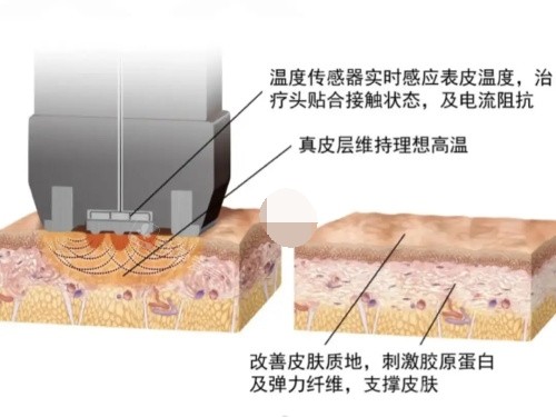 韩国想象医院官网信息整理!文内包含地址+特色项目+顾客点评...