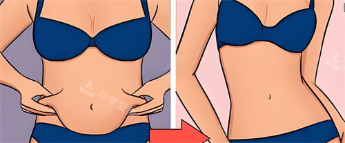 腹部吸脂术前后对比动画图