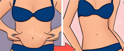 腹部吸脂術前后對比動畫圖