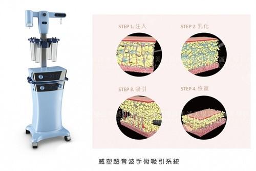 威塑手术机器与手术方式演示图