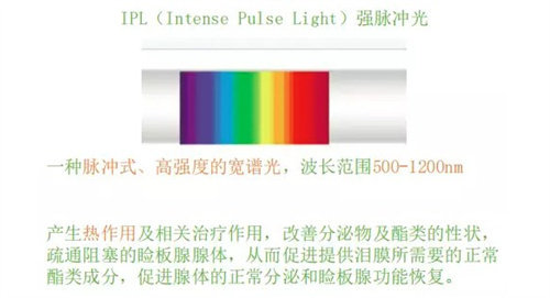 干眼癥強脈沖光 干眼癥強脈沖光