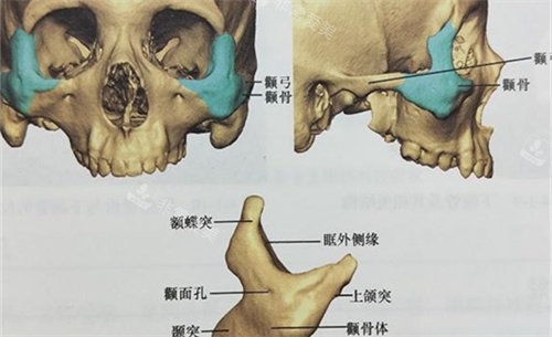 颧骨颧弓位置展示图