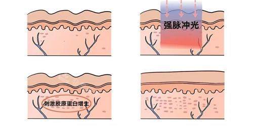 郑州光子嫩肤比较好的医院排名:东方整形/美莱整形/第二中医院整形科/缔莱美整形口碑好!