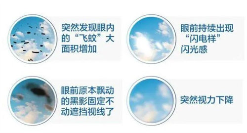 飞蚊症的前期症状