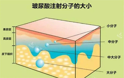 扒一扒:韩国德俊皮肤科注射玻尿酸技术怎么样?医生施术正规吗?