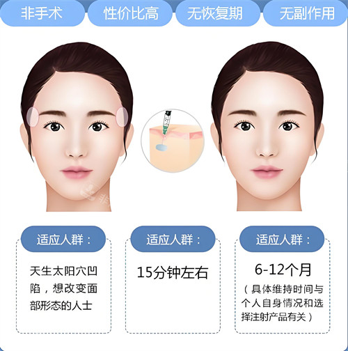 玻尿酸注射填充適合人群與原理動畫圖