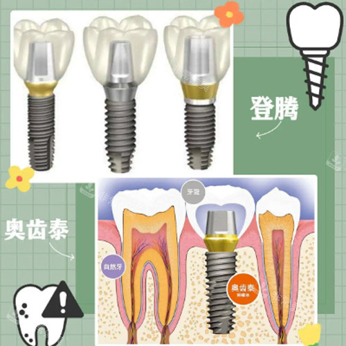 登腾奥齿泰动画图