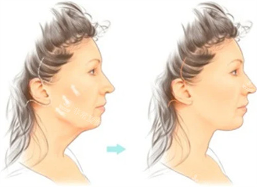 面部抗衰前后的皮肤对比