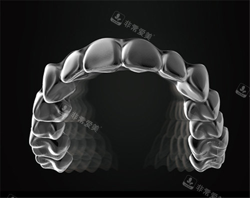 美立刻隐形牙套图示