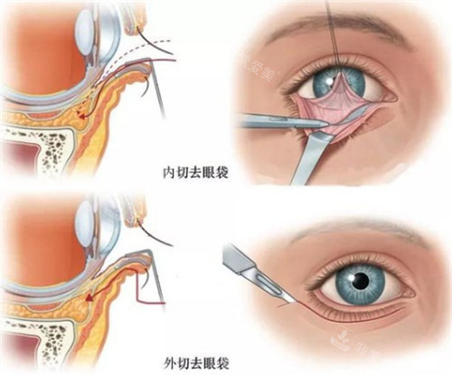 郑州去眼袋好的正规医院排名:健丽医美/美昂整形/东方整形/美莱医疗美容排名前三实力!