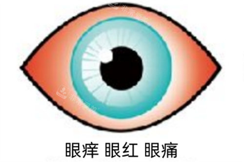 眼红