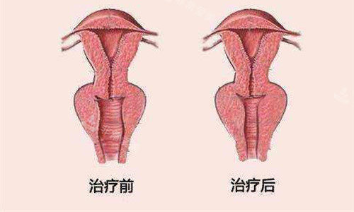 私密治疗对比图