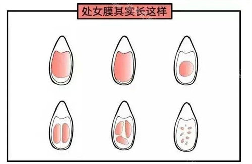 處女膜動畫演示圖