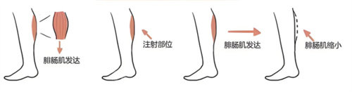 分享一家韓國本土人常去皮膚科:韓國吳佳娜皮膚科醫(yī)院!打bobo/激光溶脂均可靠~