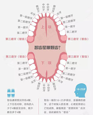 智齿位置示意图