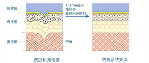 熱瑪吉工作原理動畫圖